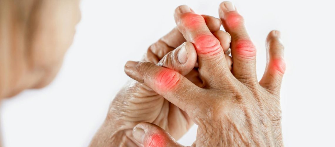 Arthrite du doigt : comprendre l'inflammation pour soulager vos douleurs